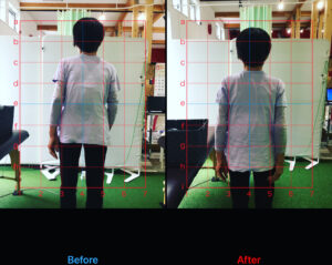 浜松整体姿勢改善