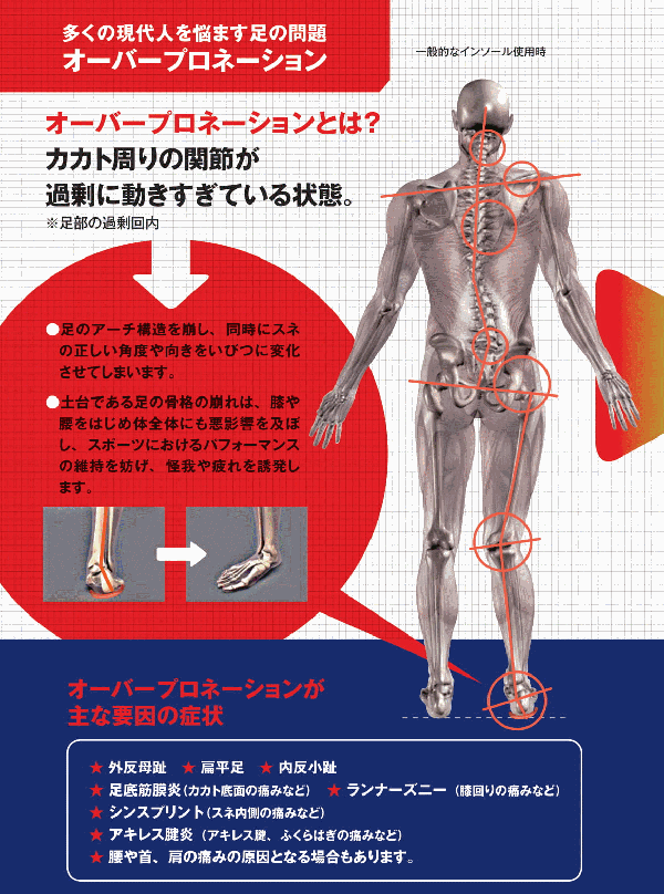 スーパーフィートインソール