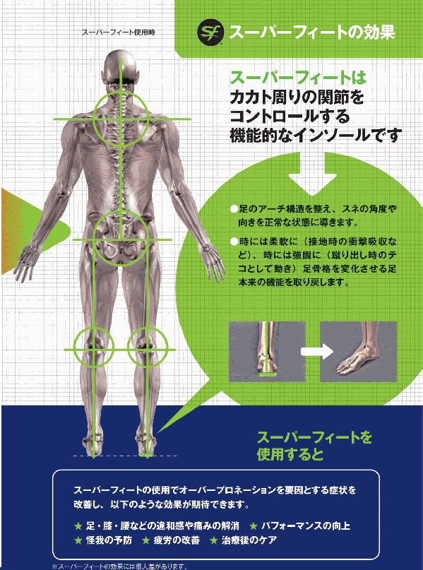 スーパーフィートインソール
