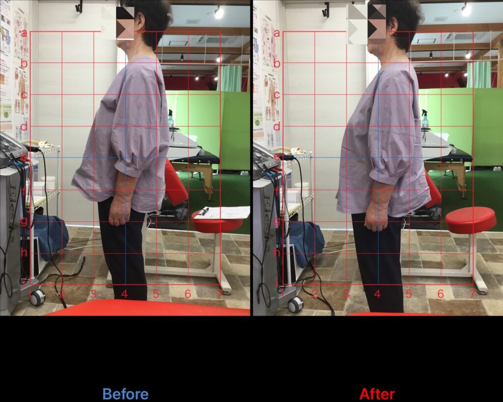 浜松整体自律神経失調症整体