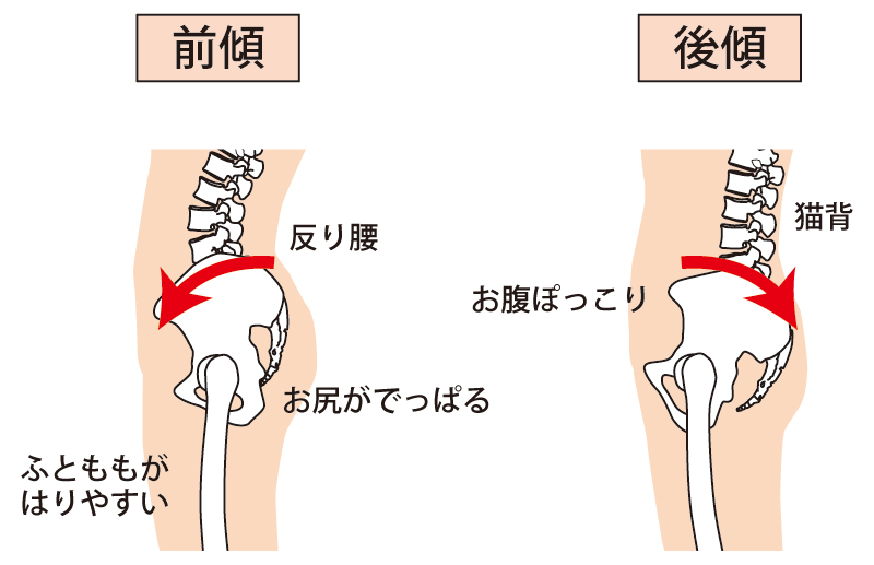 浜松反り腰整体