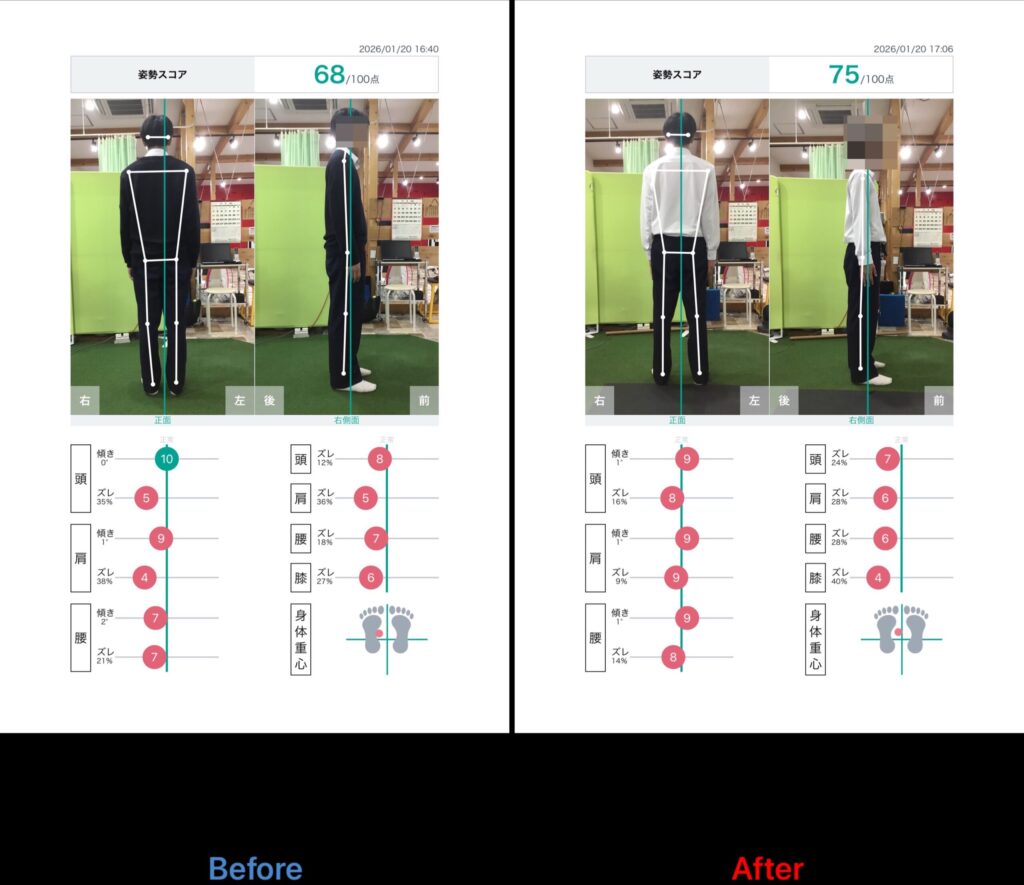 浜松姿勢矯正整体