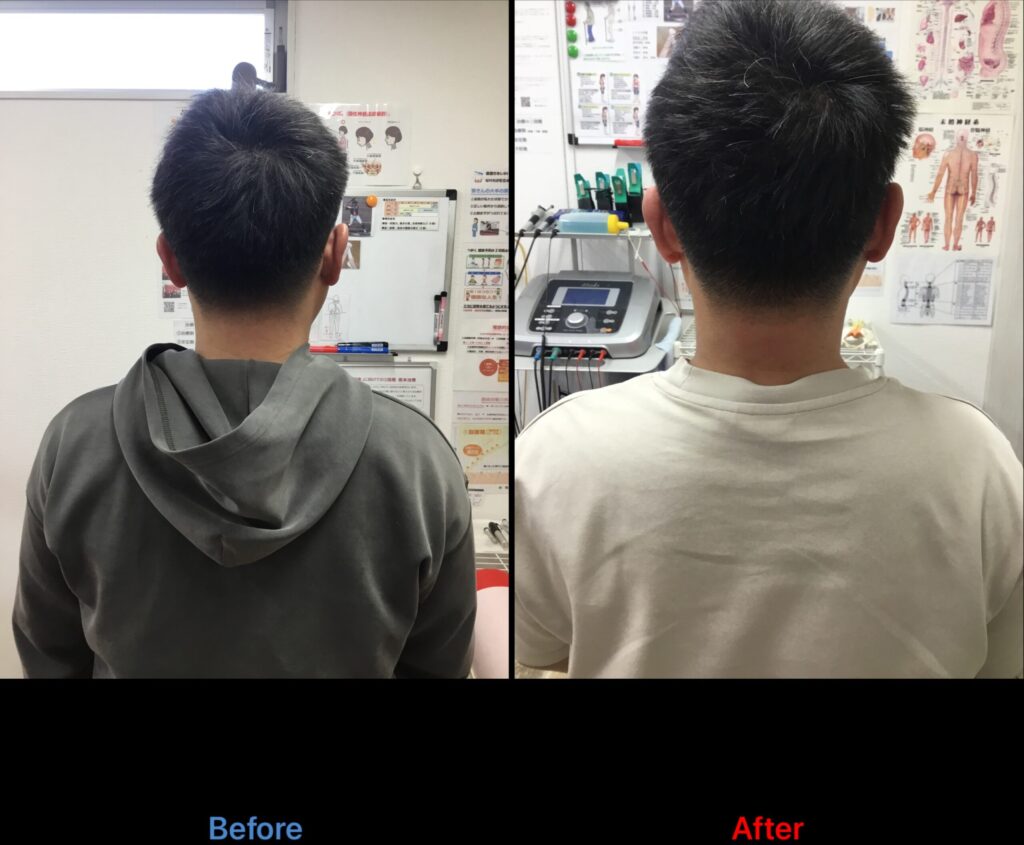 浜松首痛・手のしびれ