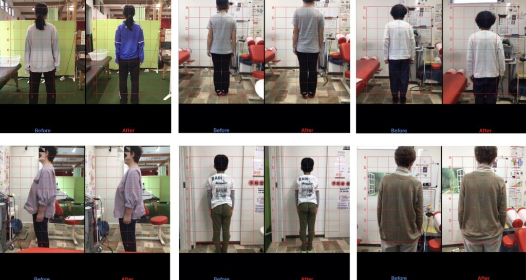 浜松整体・整骨院|肩こり・頭痛・腰痛・自律神経失調症・姿勢改善ならみんなのからだバランス整骨院・整体院