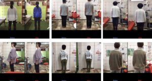 浜松整体姿勢改善例